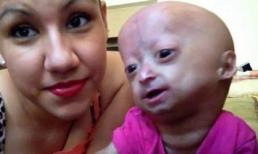 Bé gái 6 tuổi mang hình dáng bà già