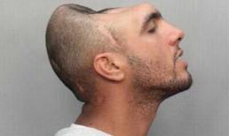 Những người có đầu biến dạng đáng sợ