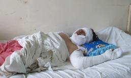 Ghen tuông, chồng tưới xăng đốt vợ