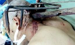 Côn đồ dùng cào sắt bổ vào đầu công an