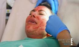 Rùng mình với những cách làm đẹp quái dị