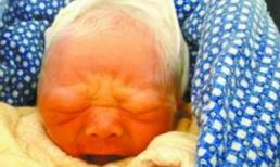 Bé trai sinh ra tóc đã bạc phơ