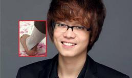 Bùi Anh Tuấn bị thương ở chân do anti-fan ném đồ lên sân khấu