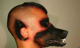 Những ca phẫu thuật kinh khủng nhất thế giới