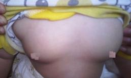 Trung Quốc: Bé gái hơn 1 tuổi ngực to như... thiếu nữ