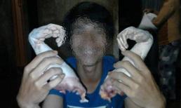 Bức xúc vì thanh niên chụp hình với 2 bàn tay khỉ