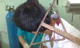 Chi tiết chưa kể vụ bổ cào vào đầu công an