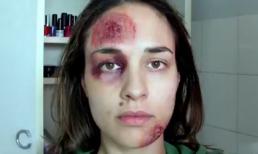 Cô gái xinh đẹp và bộ ảnh "ngày tồi tệ nhất" gây sốc