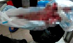 Tiết lộ của y tá ở phòng phá thai khủng khiếp nhất Hà Nội