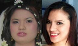 Nghi án 'gái quê' Lê Thị Phương "nâng cấp" mũi