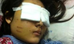 Xót xa khi gặp cô gái 19 tuổi bị người yêu bắn nát mặt	