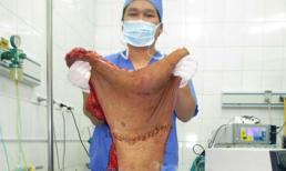 Cô gái với khối u khổng lồ, kỳ quái