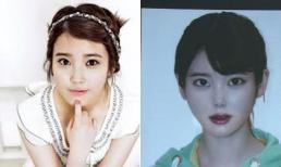 Xem gương mặt IU cứng đơ sau "phẫu thuật thẩm mỹ"