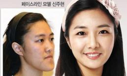 Chùm ảnh: Đẹp không tì vết nhờ công nghệ phẫu thuật thẩm mỹ 