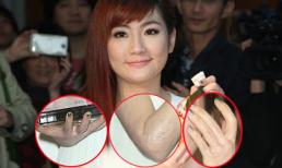 Selina lộ hàng loạt mảng sẹo lớn khi để tay trần