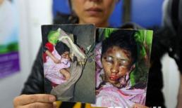 Bênh mẹ, bé 13 tuổi bị bố đánh đập tàn nhẫn rồi vứt vào thùng phân