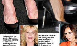 Sao US và những bàn chân biến dạng vì giày cao gót