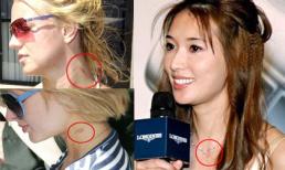 Mốt "khoe" vết bầm dập vì "yêu quá đà" của sao (P2)