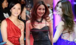 Khoảnh khắc da thịt "ngồn ngộn" mỡ của sao