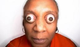 Những con mắt kinh dị "nhất quả đất"