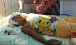 Bé bị máy ép nước mía lột da đầu khóc đòi đi học