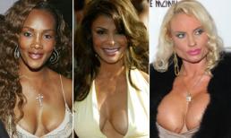 10 bộ ngực méo mó nhất Hollywood