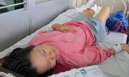 Đôi vợ chồng bị máy cắt cỏ chém đứt bàn chân