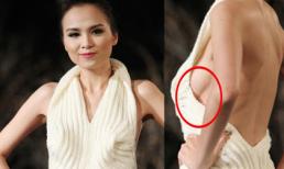 Diễm Hương lộ dấu vết "nâng ngực"