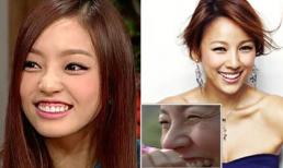 Đặc điểm xấu trên cơ thể của 10 sao Hàn