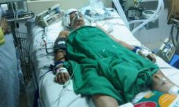 Chồng chém vợ 'lòi não' giữa đêm khuya