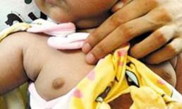 4 tuổi đã dậy thì vì thuốc tránh thai của mẹ