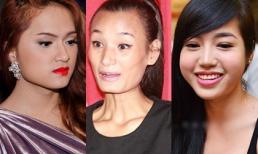 "Khai quật" những góc mặt "lồ lộ xấu" của sao Việt