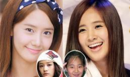 "Sốc" với ảnh trước khi thẩm mỹ của SNSD