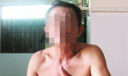 Góc nhìn pháp luật vụ cắn “của quý”