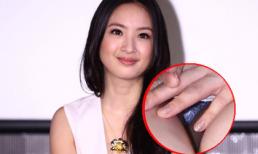 Lâm Y Thần hớ hênh lộ nội y