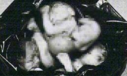 Bí ẩn ‘quy trình’ xử lý thai nhi sau nạo hút