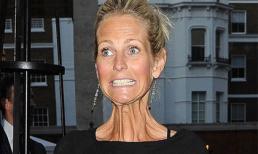 Sao nữ gây sốc với chiếc cổ "nhăn nhúm" kinh dị