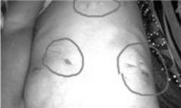 Giết chết cô gái 16 tuổi rồi cắt ngực trong đêm