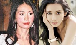 Mỹ nhân Hoa ngữ đương đầu với bệnh da liễu