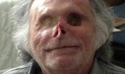 Biến dạng vì bị kẻ ăn thịt người cắn nát