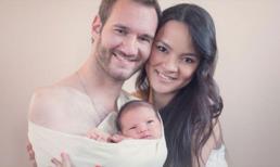 Chuyện sinh con của người khuyết tật như Nick Vujicic