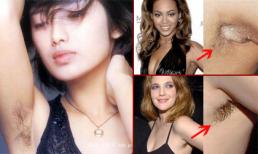 Phát hoảng vì 'vùng cánh' chi chít 'vi-ô-lông' của sao