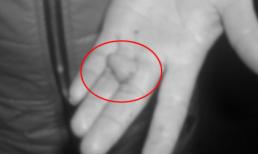 Giở trò đồi bại, "yêu râu xanh" bị... cắn đứt lưỡi