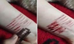 Thiếu nữ thất tình rạch tay gây sợ hãi