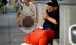 Hình ảnh phẫu thuật "của quý" 45kg gây sốc