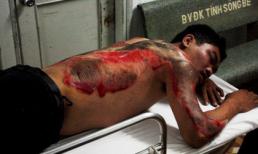 Doanh nhân lái xe say xỉn, kéo lê tài xế taxi 100 mét