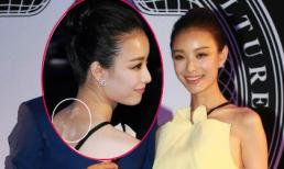 Sao Trung lốm đốm mỹ phẩm sau lưng vì lơ đãng