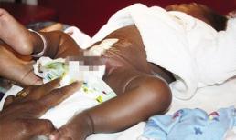 Em bé có 4 chân đáng thương