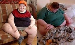 Cậu bé 13 tuổi nặng 180kg