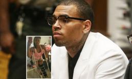 Chris Brown bị cáo buộc đánh phụ nữ đứt cả dây chằng